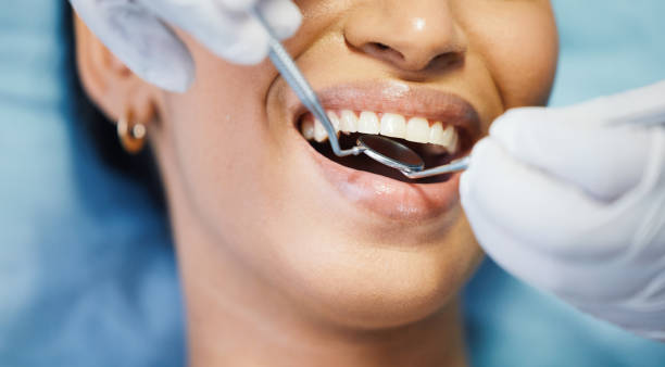 Best Emergency Wisdom Teeth Removal in Plymouth, WI